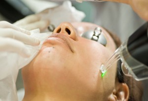 Acne Laser Treatment