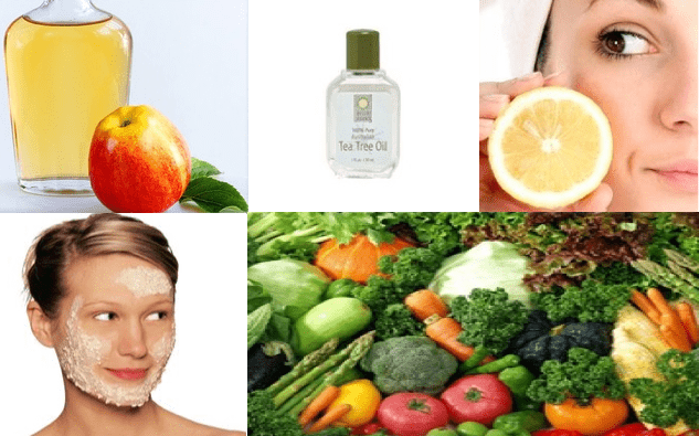 5 Surprising Home Remedy Acne Treatments