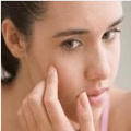 Acne: What it Is and How to Fight It