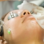 Acne Laser Treatment