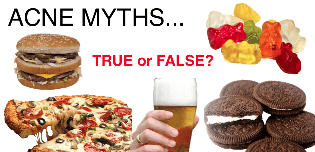 Well Defined Acne Myths – True or False?