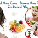 Natural Acne Cures