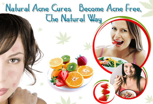 Top Things To Do To Heal Acne