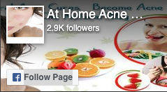 ”FB-Followers”