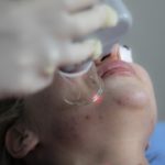 Consult Dermatologist For Mild To Moderate Acne vs Over Counter Products